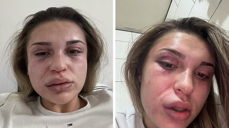 Съдят 21-годишен от Кресна тормозил, отвлякъл и пребил зверски в гората над града бившата си приятелка