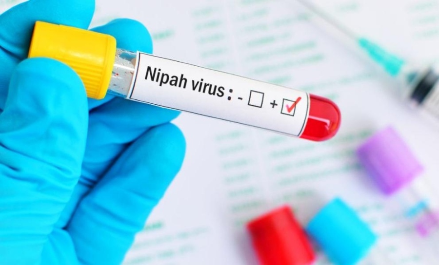 Вирусът Нипа: какво представлява, има ли опасност за България