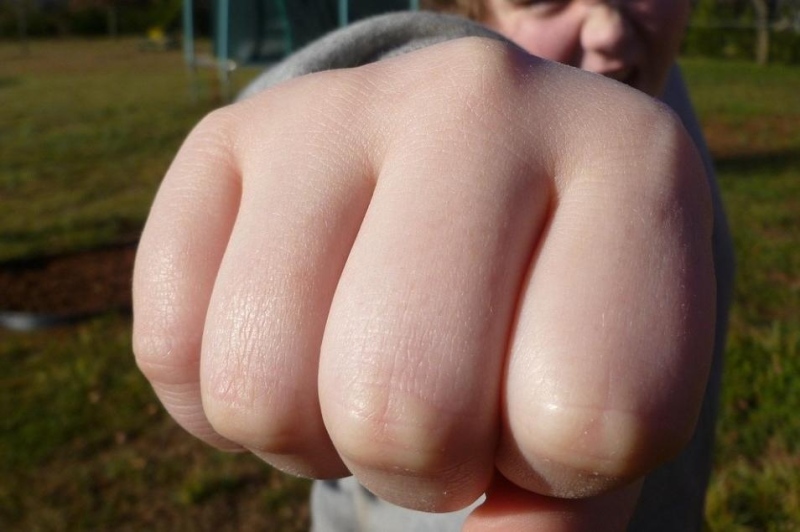 14-годишен заби юмрук в окото на връстник от Самораново, полицията разследва