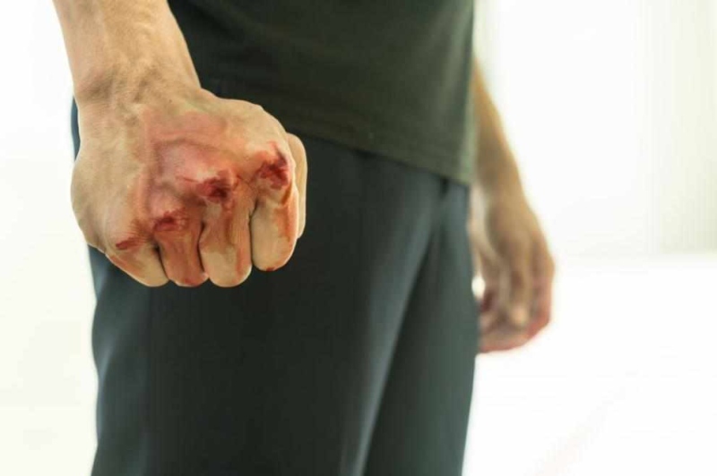 Кървав бой в Софийско: Мъж е с фрактура на черепа и опасност за живота