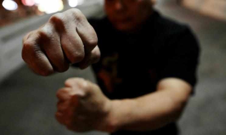 47-годишен мъж е с комоцио и три счупени зъба след побой в Добринище